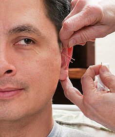 Acupuncture For Ringing in the Ears