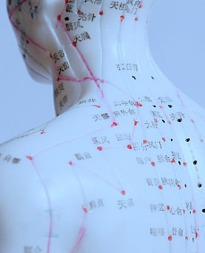 Photo of Acupuncture treatment locations